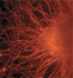 orange nerve cell